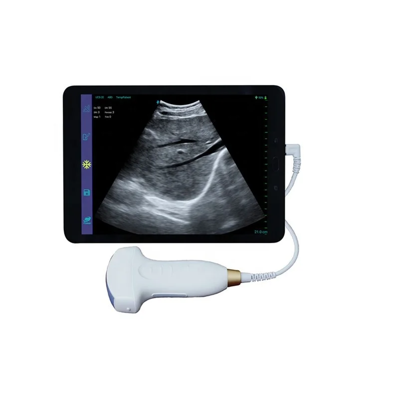 

Digital hand held USB convex probe ultrasound