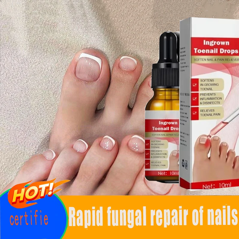 

Nail Treatment Essence Ingrown Toenail Correction Drops Nail Fungus Treatment Essence Serum Nail Fungus Repair Toenail Care