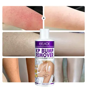 8 best sales جلد الدجاج - №4