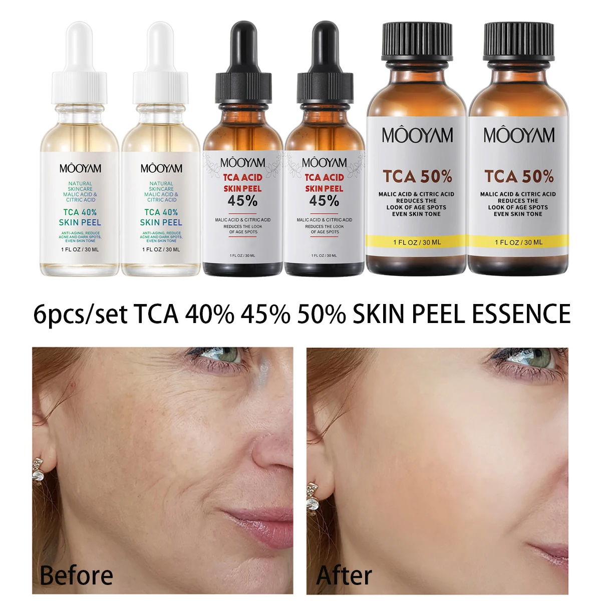 

6 шт., увлажняющая сыворотка для пилинга лица, 40%, 45%