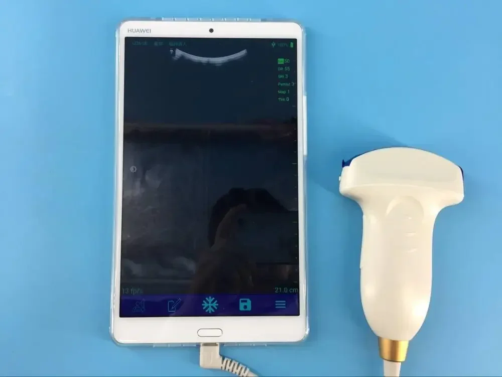 Cheapest price ecografo lineal Ultrasound probe  in cell phone and notebook