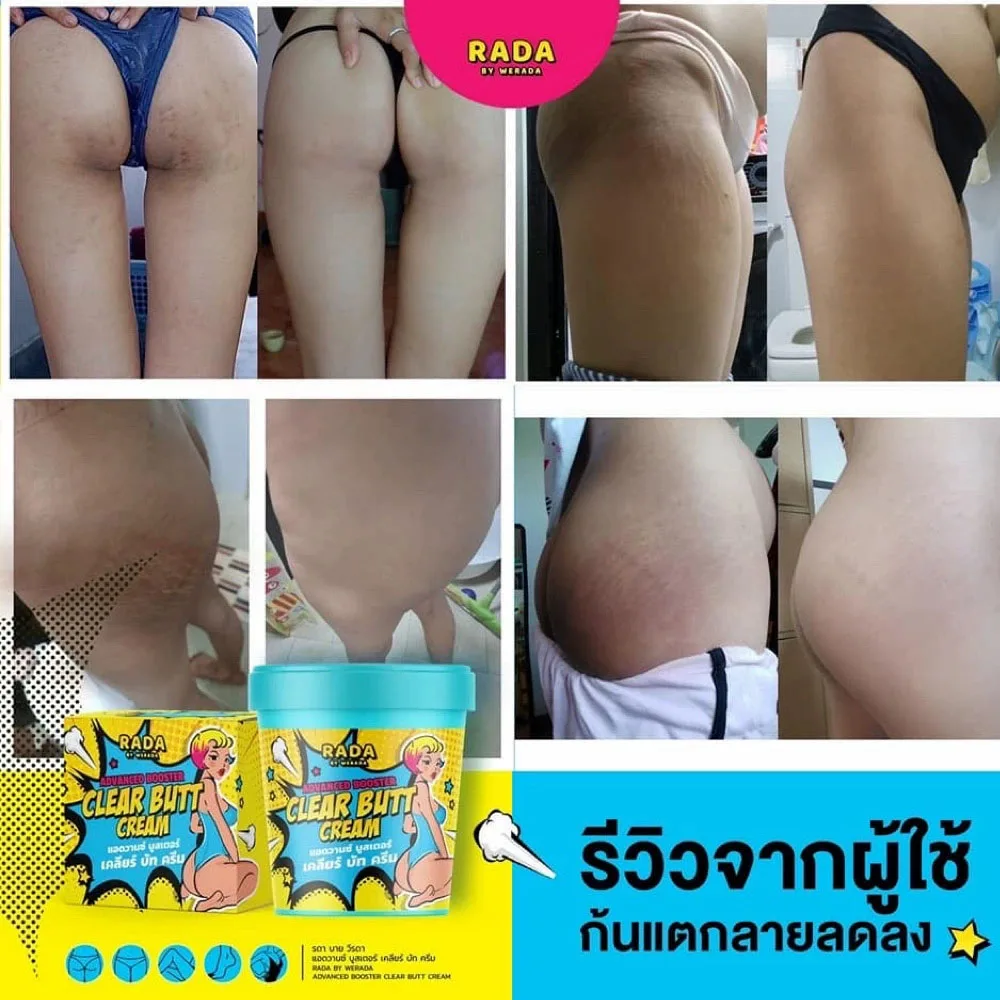 Rada By Werada Advanced Booster Clear Butt Gel Reduce Stretch Marks Melanin Clear Skin For Buttocks, Elbows, Armpit, Privates