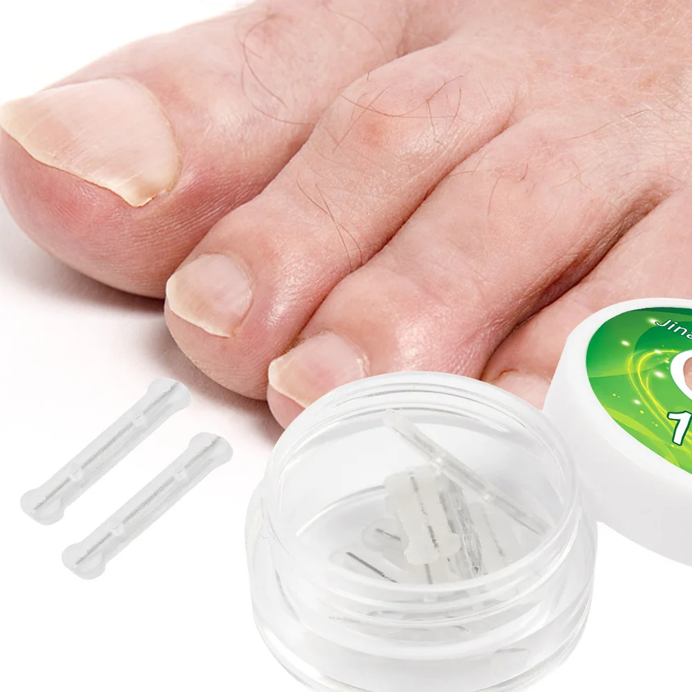 10 個のチタン合金シリコーン陥入爪矯正器再利用可能な耐摩耗性ネイルツール毎日の家庭用フットケア