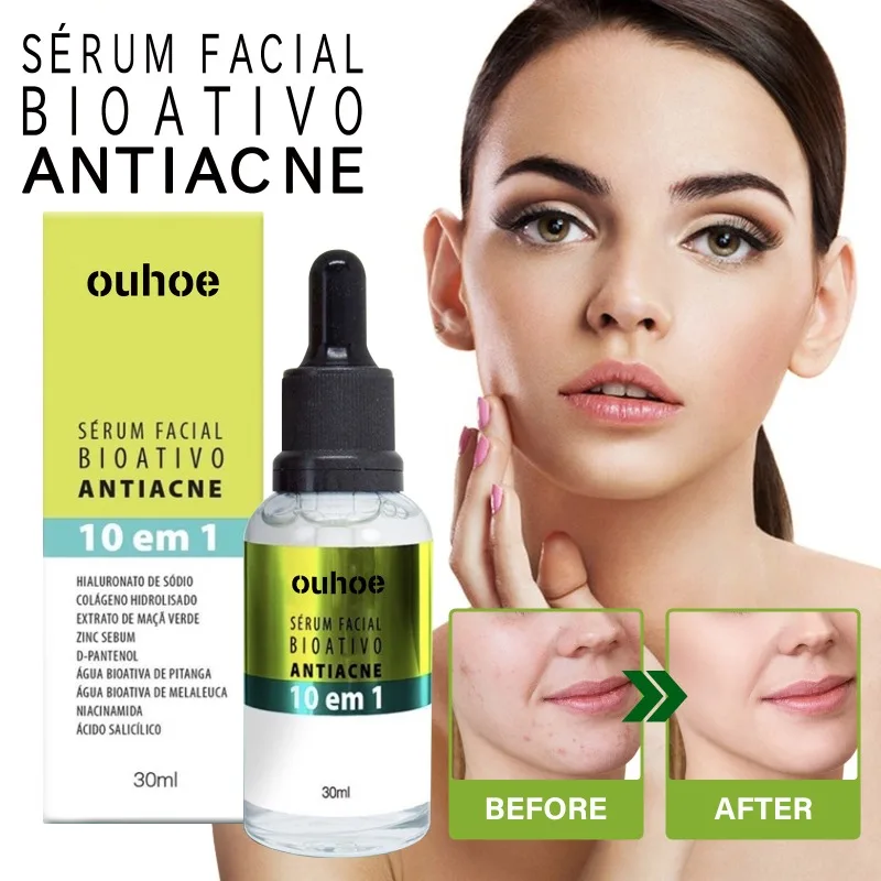 Bioactive Acne Mark Essence Anti Aging Fading Spots Acne Marks Closing Mouth Nourishing  Whitening Moisturizing Skin Essence