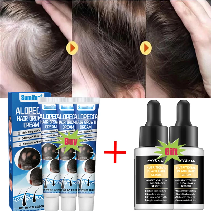 

7 days Fast Hair Growth Cream Anti Hair loss Prevent Baldness Scalp Treatment Repair Roots Beauty Health Hair Care For Men Women