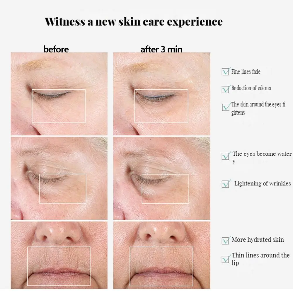 Crema para ojos para eliminación de arrugas, instrumento I-mport, pluma masajeadora de ojos, masaje de vibración Facial, masajeador Facial eléctrico, dispositivo de belleza para ojos