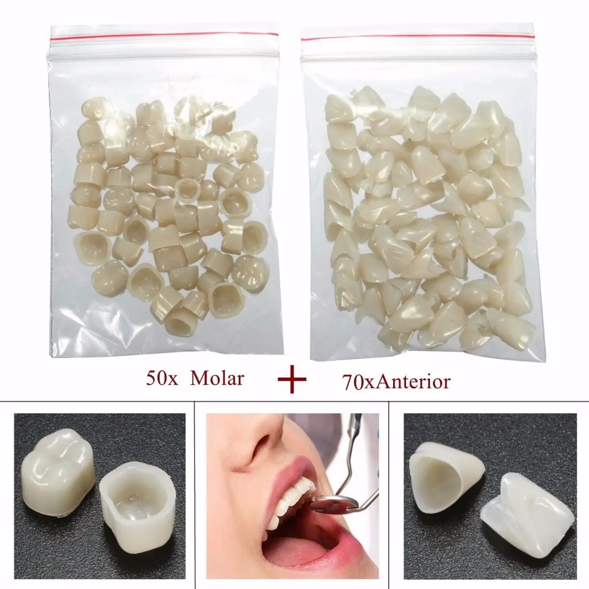 120PCS (50 Molar + 70 Anterior ) Dental Teeth Veneers Temporary Crown Set