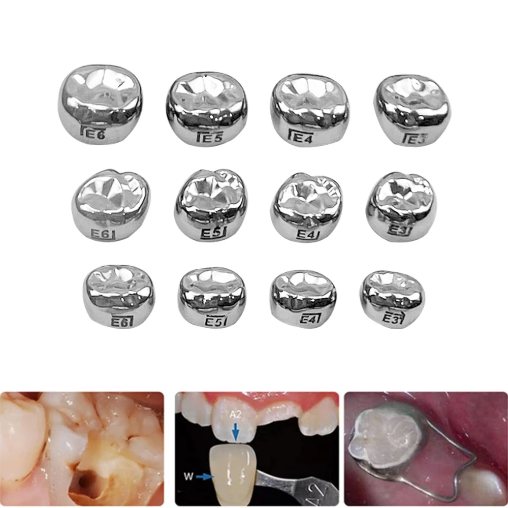 

5Pcs Dental Crown Kids Primary Molar Teeth 1st 2nd Stainless Steel Pediatric Temporary Crowns Upper/Lower Left/Right dental tool