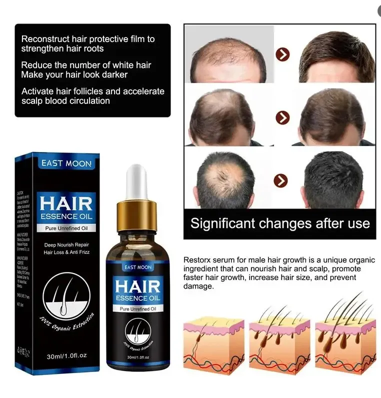 Hair Growth Oil Fast Hair Growth Effective Baldness Repair Hereditary Hair Loss Postpartum Hair Loss Seborrheic Hair Loss Care