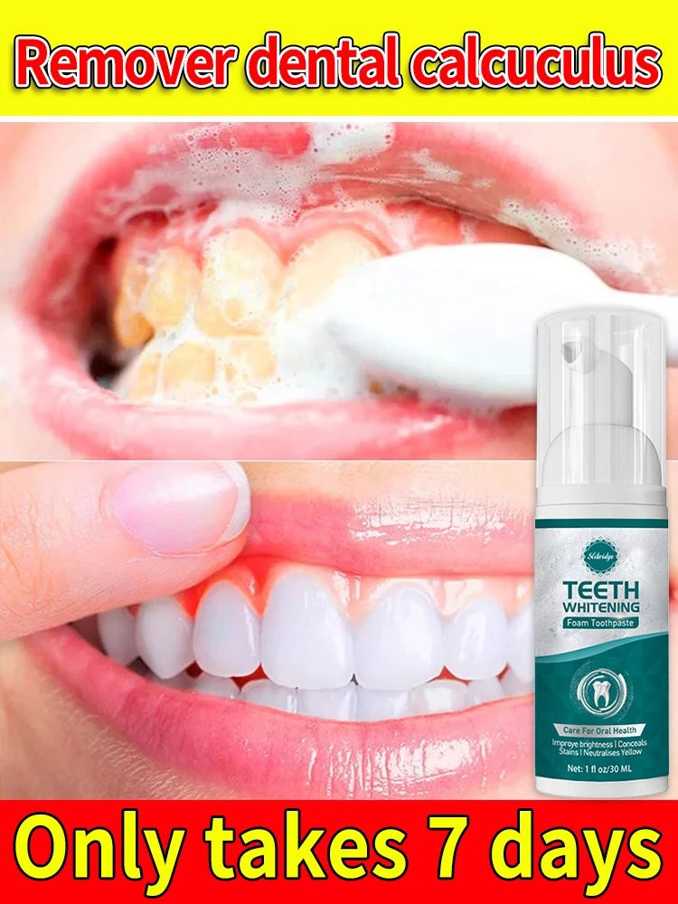 Resolverantum Los Балка Dentales