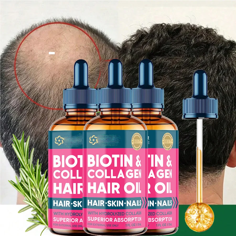 

3 件套 Biotin Hair Care Nourish Oil Hair Follicle Reduce Hair Loss Stabiliz Hair Root Refresh Oil Control Natural Plant Essence