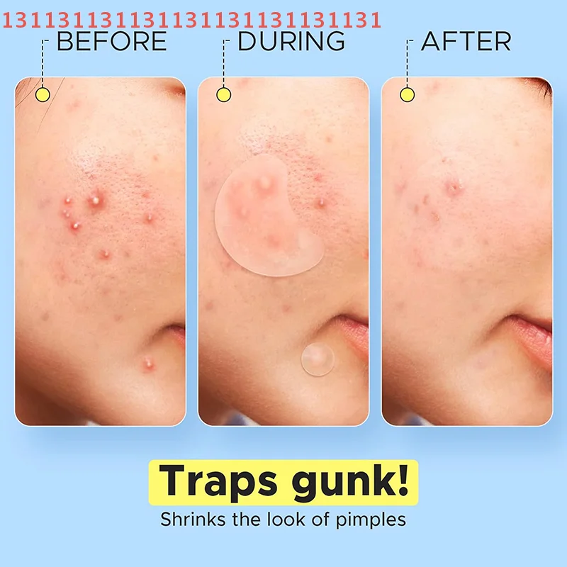 

Beauty Makeup Repair Stickers for Spots Marks Skin Care Tool 40Pcs Invisible Anti-Acne Patches Pimple Removal Concealer