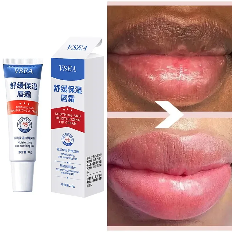 

Lip Whitening De-Blackening Lip Balm Exfoliating Fade Lip Lines Moisturising Moisture Dead Skin Removal Korean Skincare