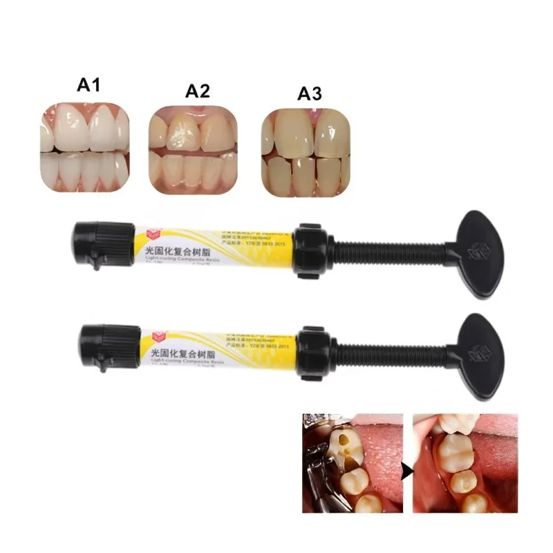 2.5g Dental Light Curing Composite Resin A1 A2 A3 Tooth Restoration Dental Materials Cavity Filling and Repair Dental Supplies