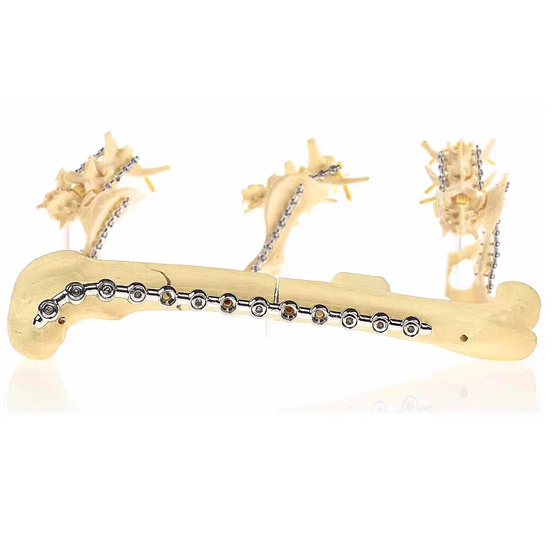 SOP PEARL locking bone plate ALPS veterinary orthopedic instruments TPLO pet animal surgical winortho kyon cortex screws