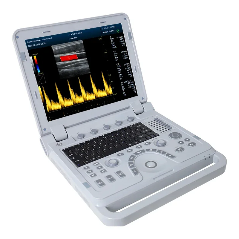 CONTEC CMS1700B 4D Color Doppler USG Color Cardiac Ultrasound Scanner Diagnostic Machine Systems Micro Convex Probe