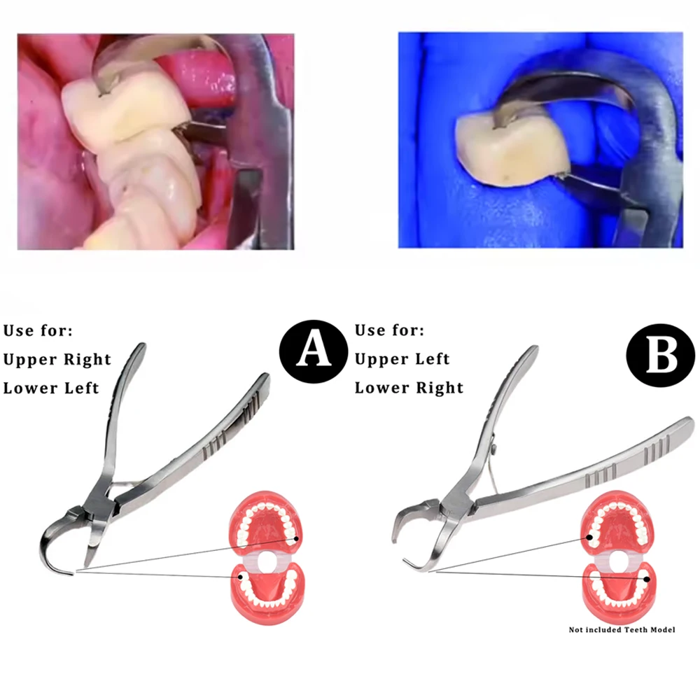 

Stainless Steel Dental Crown Extractor Pliers for Tooth Removal Extraction Surgery and Orthodontic Procedures