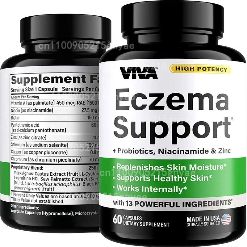 

Eczema Relief Supplements - Target Skin Irritation & Support Psoriasis Care