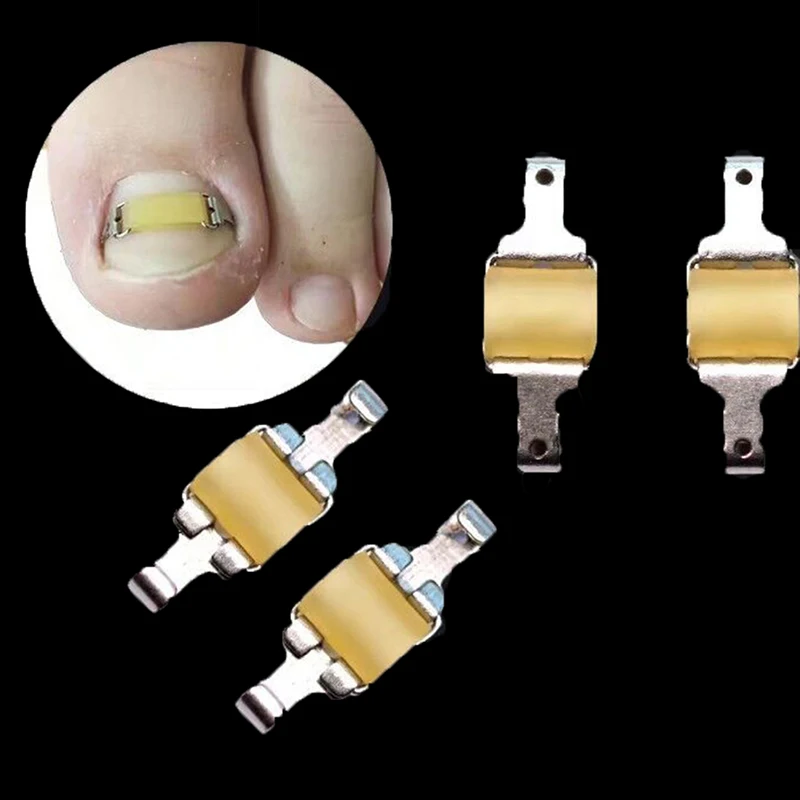 1Set Ingrown Toenail Corrector Tools Pedicure Professional Ingrown Toenail Correction Foot Care Recover Embed Toe Nail Treatment