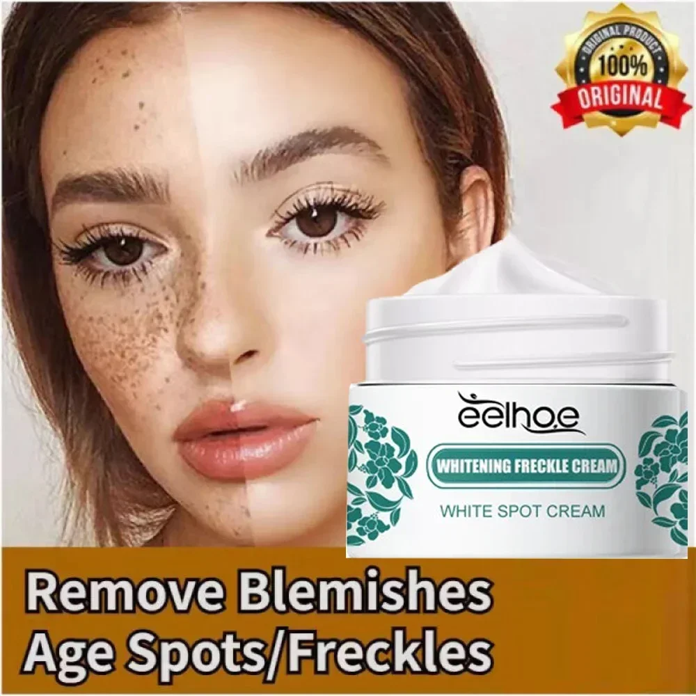 Pecas blanqueadoras, elimina manchas oscuras, pecas, ilumina la piel Facial, reduce la melanina, ilumina la piel oscura