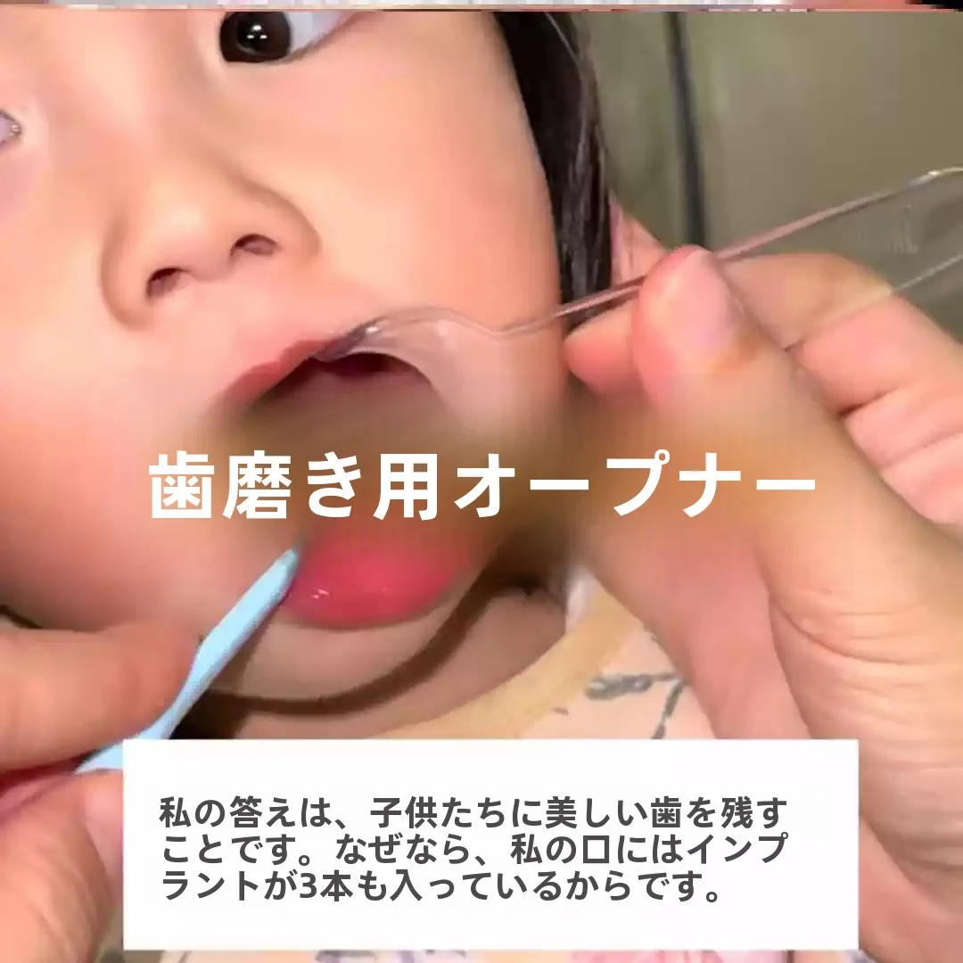 dispositivo-auxiliar-para-escova-de-dentes-de-bebe-expansor-bucal-anti-mordida-com-cabo-ferramenta-de-treinamento-para-higiene-oral-infantil-escova-para-abertura-bucal