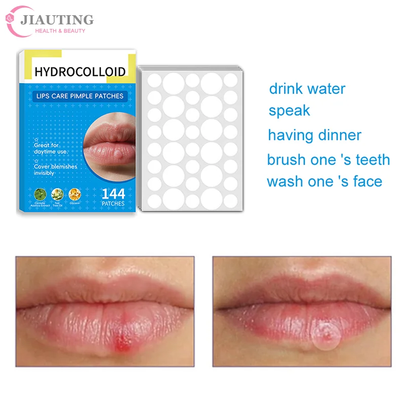 

144 шт., блистер для рта, патч для блистеров для губ, холодный боль, исцеление, гидроколлоидные наклейки для ухода за губами, пластырь для блистер для рта