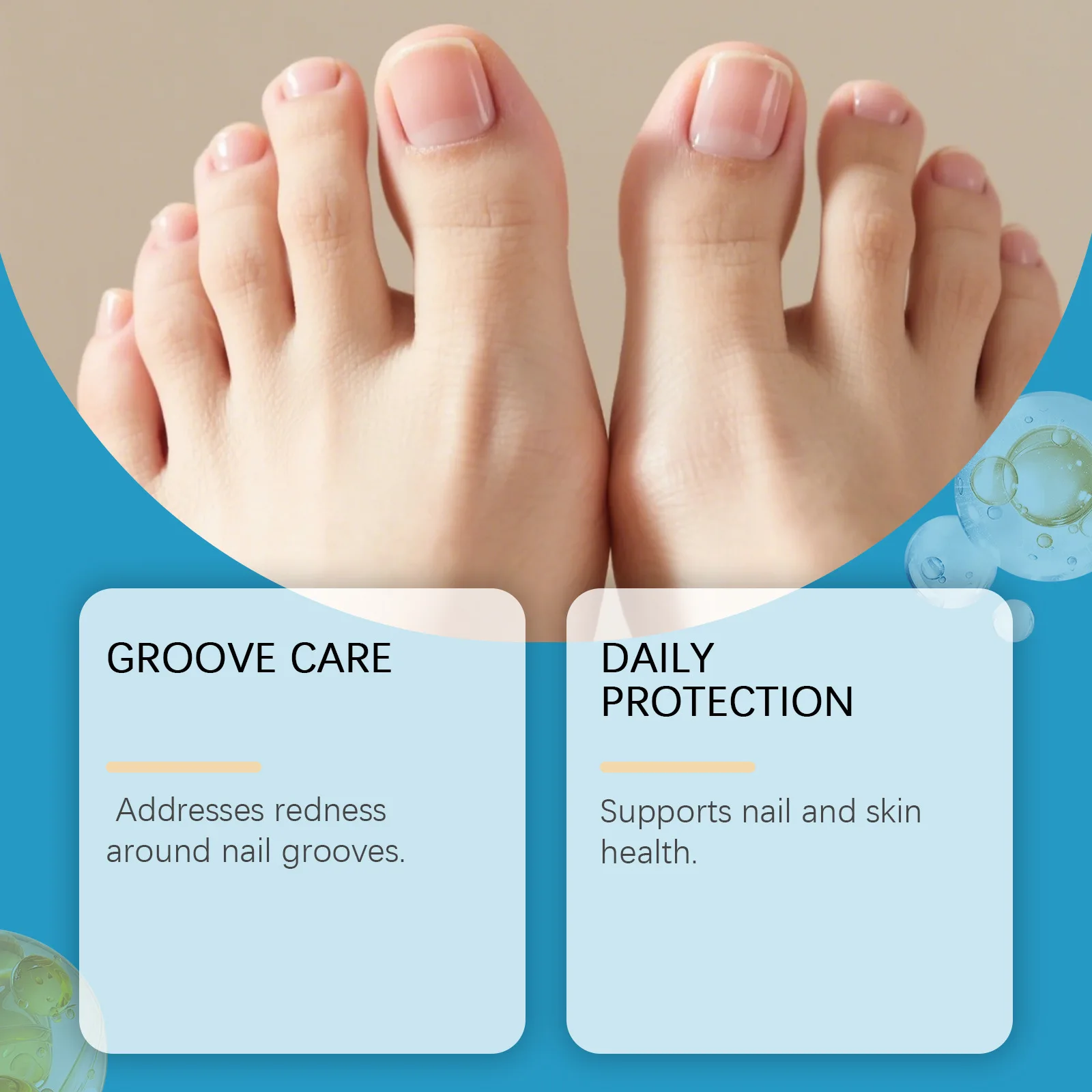 Paronychia Verwijdering Olie Vernieuwing Hand Voet Teen Nagel Repareren Anti Infectie Onychomycose Behandeling Schimmel Ingegroeide Teennagel Zorg