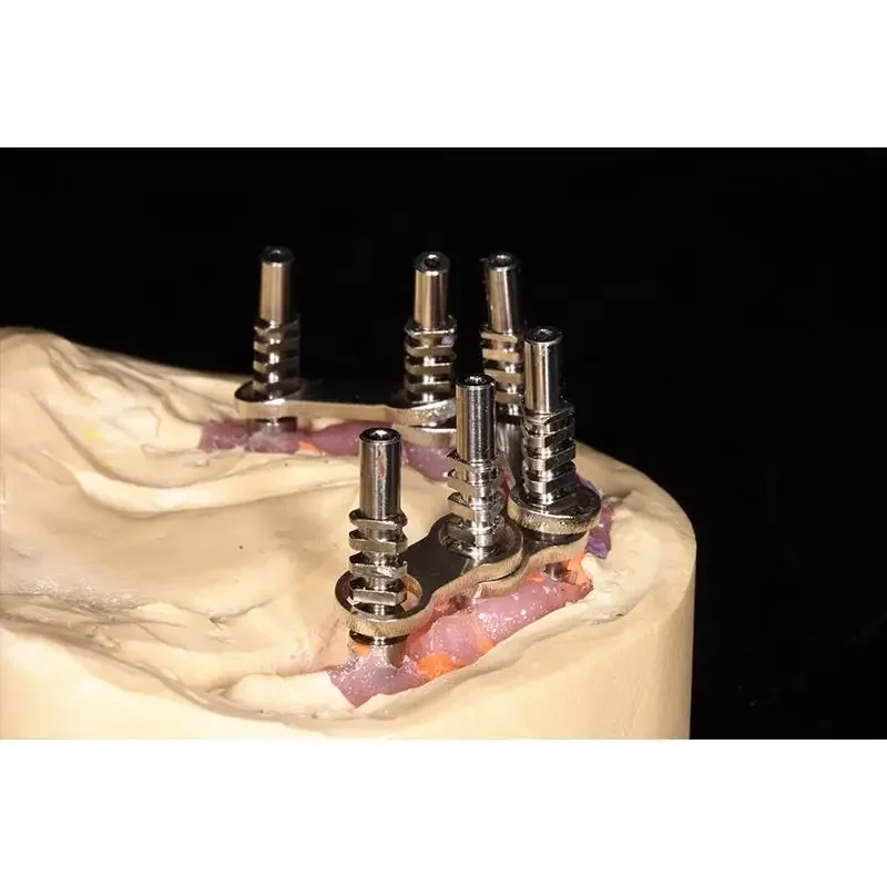 Todo en 4 prótesis dentales, barra de sobredentadura con soporte de implante de Metal, 70 piezas