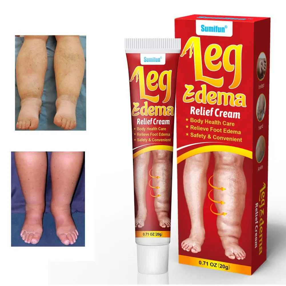 20g Leg Relief Cream for Circulation Relieve Foot Edema Massage Cream for Swollen Legs and Ankles Body Health Care