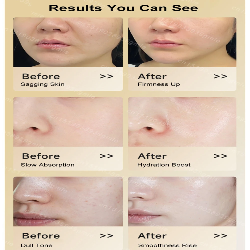 Appareil de beauté du visage à microcourant, Anti-rides, rajeunissement de la peau, masseur Facial, raffermissement de la peau, masque stimulateur musculaire du visage