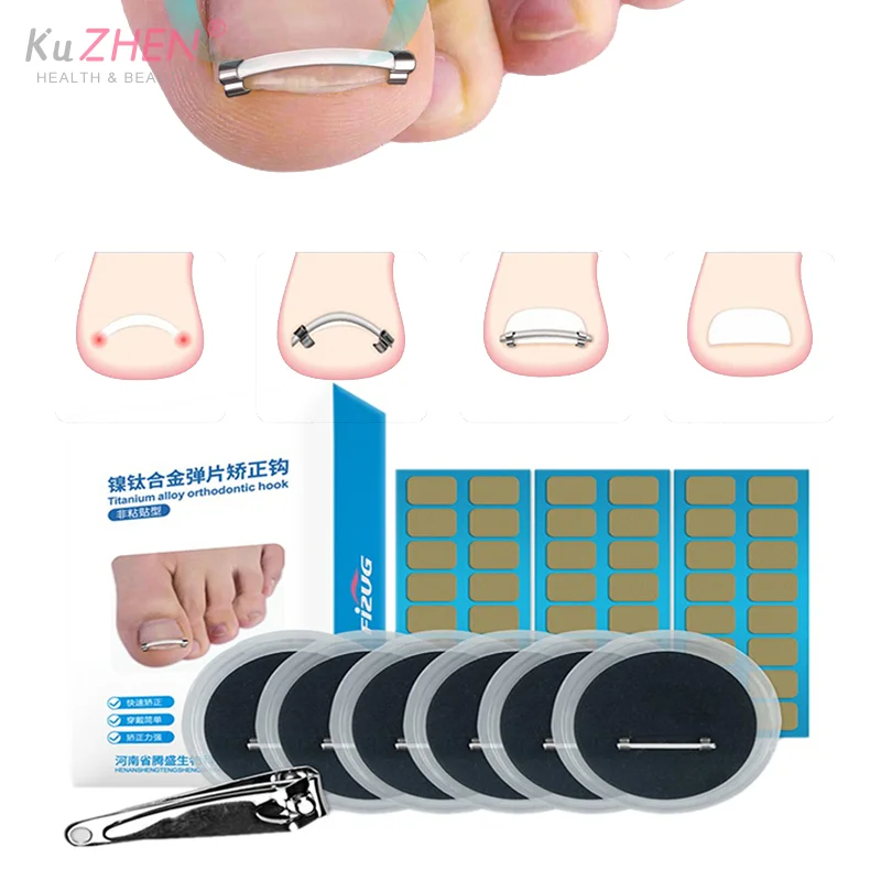 Ingrown Toenail Pedicure Tool Embed Toe Nail Care Straightening Correction Clip Curved Clamp Toenails Correction Tool For Toes