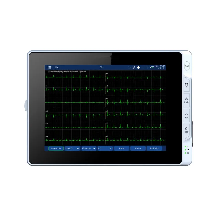 Digital Portable ECG/EKG 12 Leads 6 Channel ECG Echocardiography Machine Price