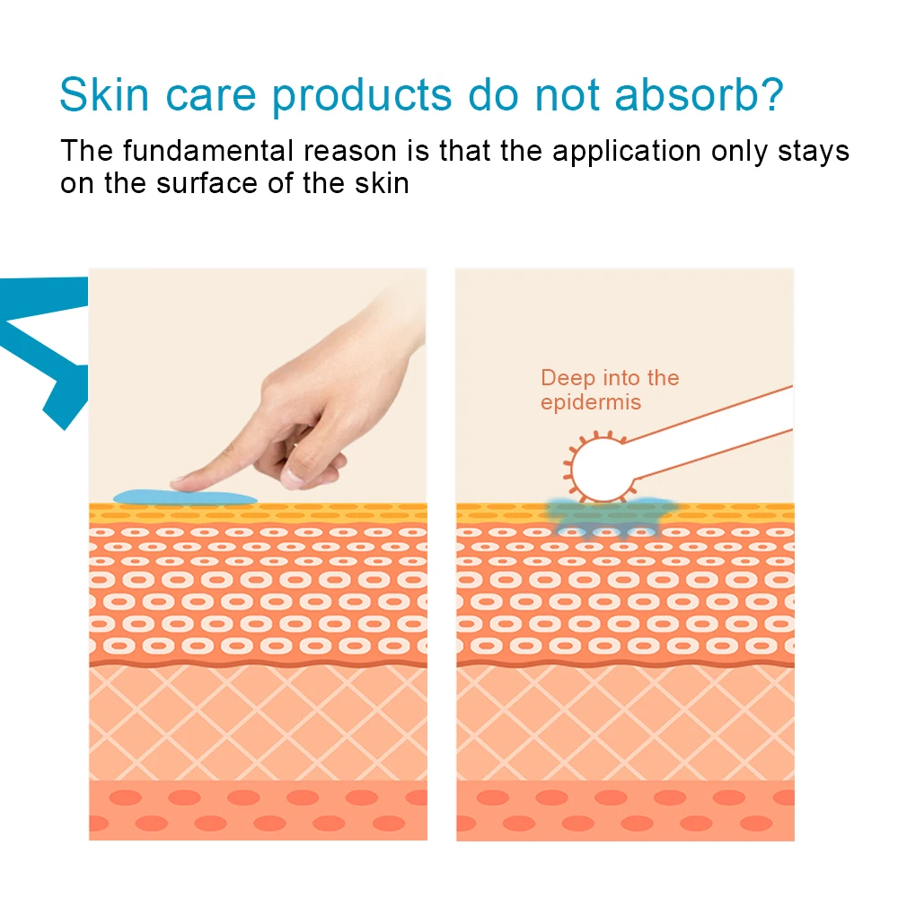 1pc 540 Needles Derma Roller for Facial Beauty Care Beard Hair Growth 0.2mm 0.25mm 0.3mm Micro Needle Roller Face Skin Care Tool