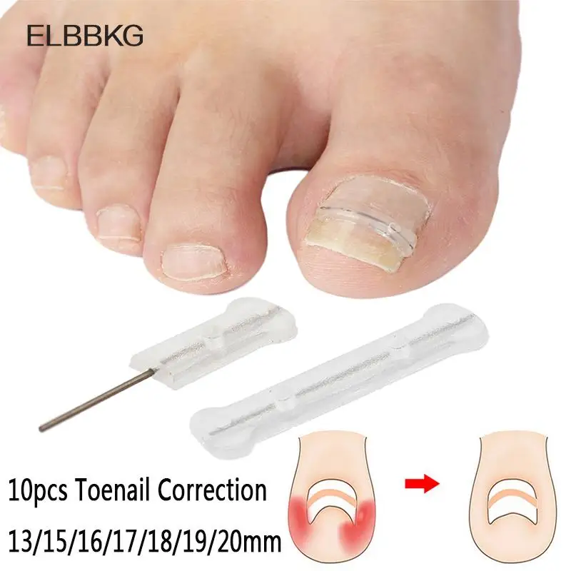 10pc/box Ingrown Toenail Correction Tool Ingrown Toe Nail Treatment Elastic Patch Sticker Straightening Clip Brace Pedicure Tool