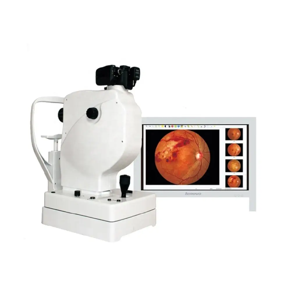 Hot Selling AIST SK-650A Digital Retinal Camera Price Popular Model SK-650A Nonmydriatic Fundus Camera