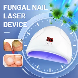 Nail Fungus Laser Fungal Nail Treatment Device Repair Toenail Fungi Nails Feet Therapy Onychomycosis Fingernail Removes Pedicure