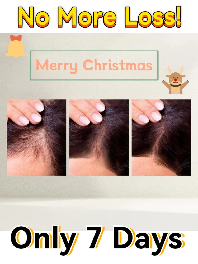 Espessador de cabelo fino, amplifica rapidamente a densidade do cabelo e fortalece os fios, obtenha o cabelo grosso parecer você deseja