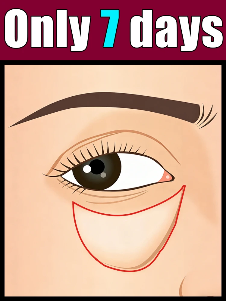 

Новинка! Паста для ухода за глазами 2026: Горячая Продажа! Формула с пробиотиками для подавления патогенного роста и улучшения гигиены глаз