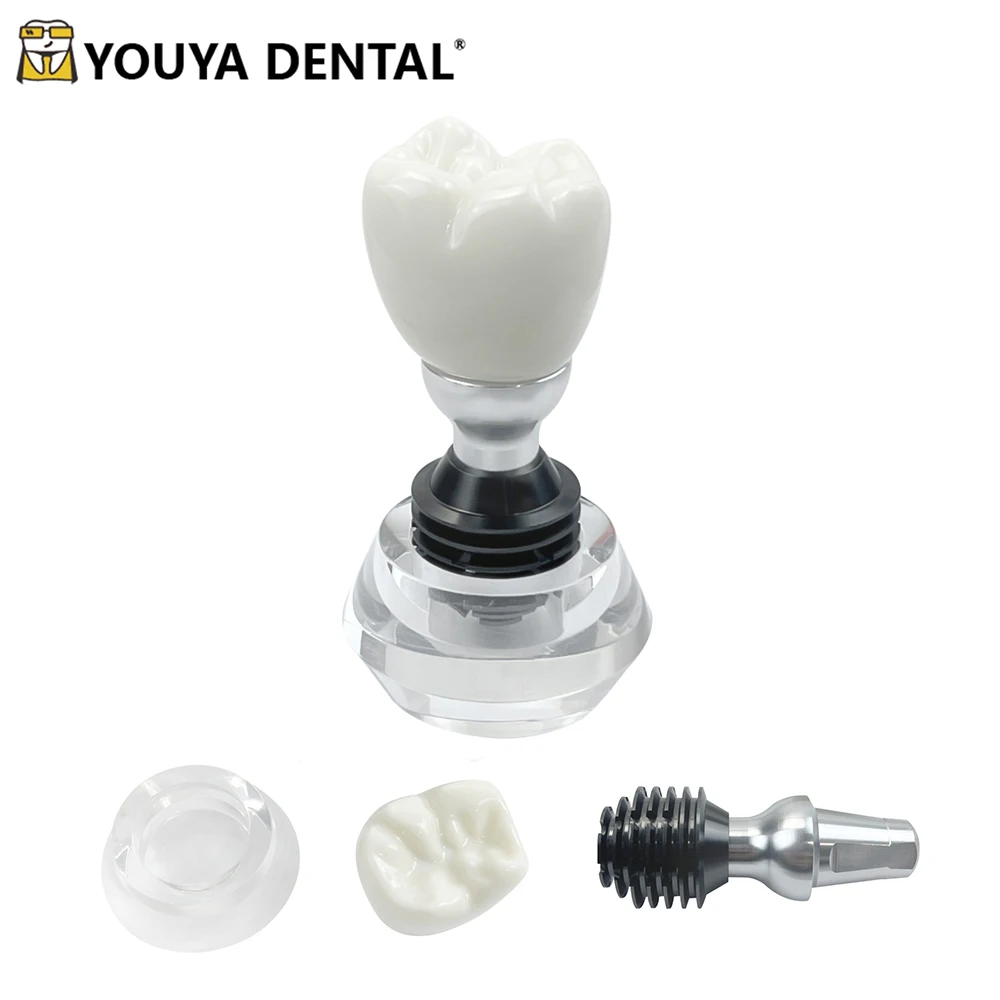 Single Tooth Crown Model Detachable Teeth Implant Demonstration Model Crystal Dentistry Teach Study Model For Dentist Clinics