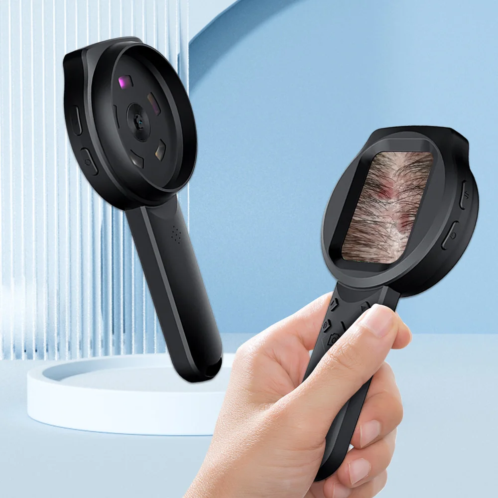 يده Dermatoscope آلة محلل الجلد اللاسلكية المحمولة مجهر رقمي لفروة الرأس/الشعر تريكومز تحليل بشرة الوجه #3