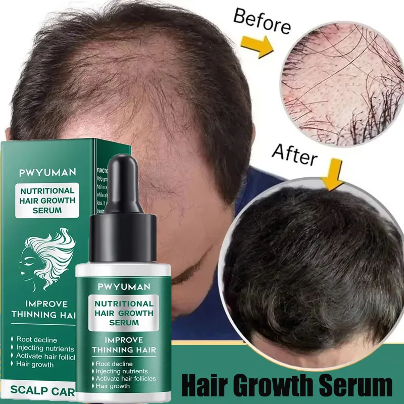 

7 Day Hair Growth Serum Anti Hair Loss Products Fast Growing Prevent Dry Frizz Damaged Repair Treatment Scalp Beard Care Essense