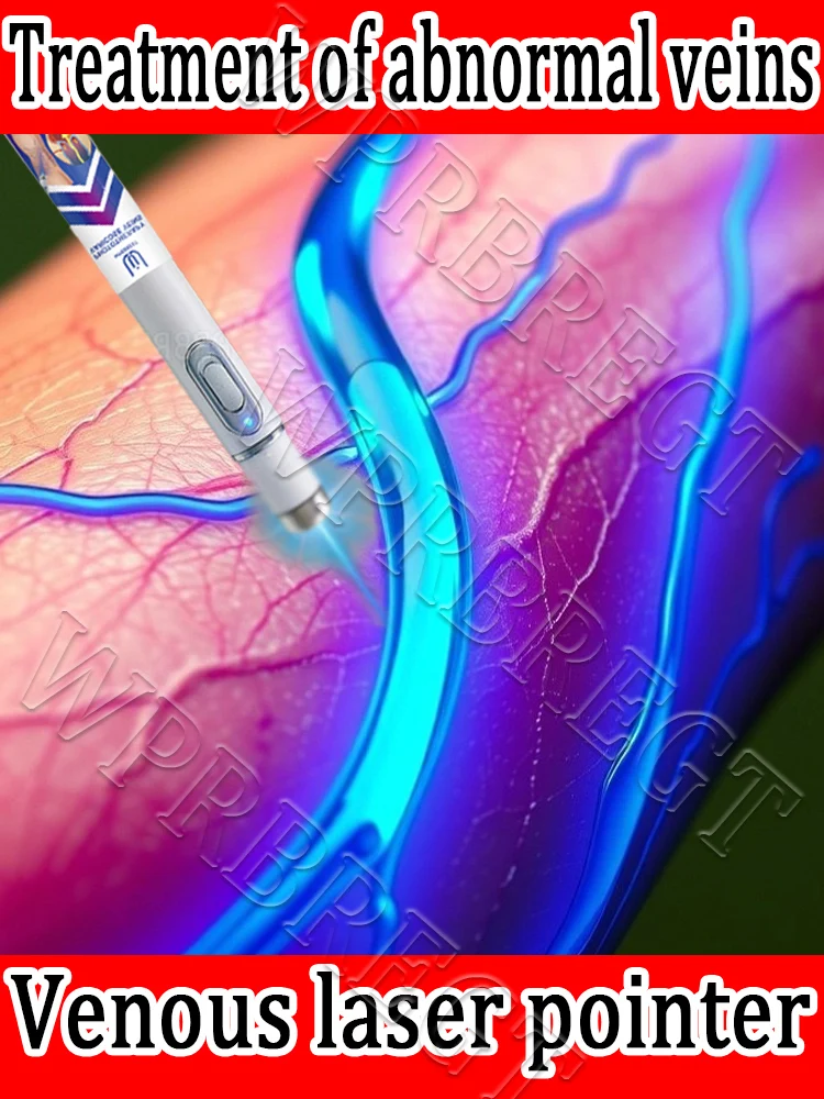 

Relieves vasculitis and phlebitis, spider leg pain, laser pointer therapy