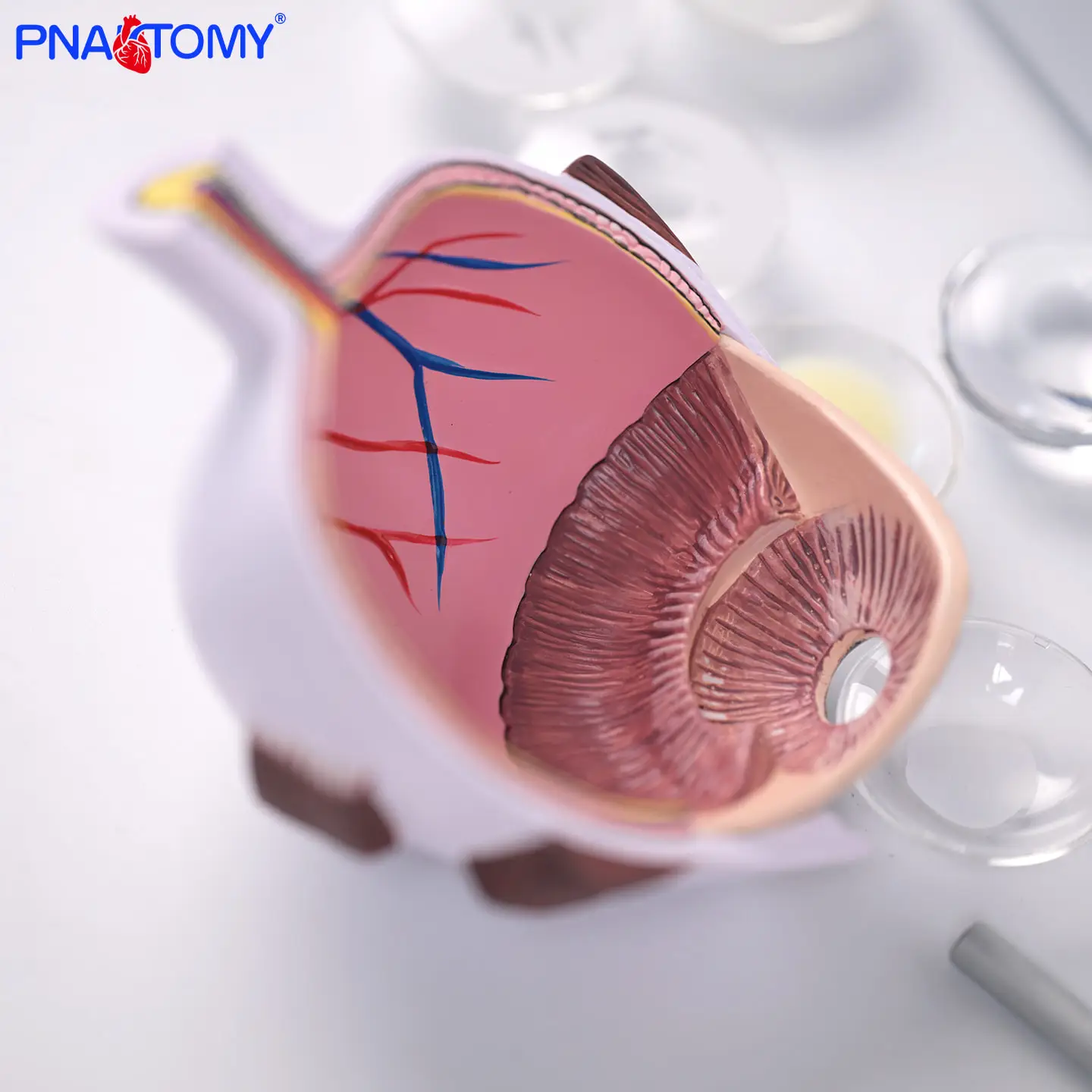 

Pathological Eyeball Model Eyeball Model Corneal Lesion Eyeball Model Medical Teaching Material Model
