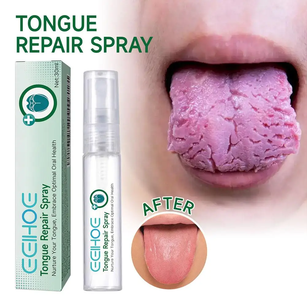 EELHOE Tongue Repair Spray Repair Tongue Whitening Dry, Oral Spray Cracked Care Swollen Relieve Tongue To And A0T7