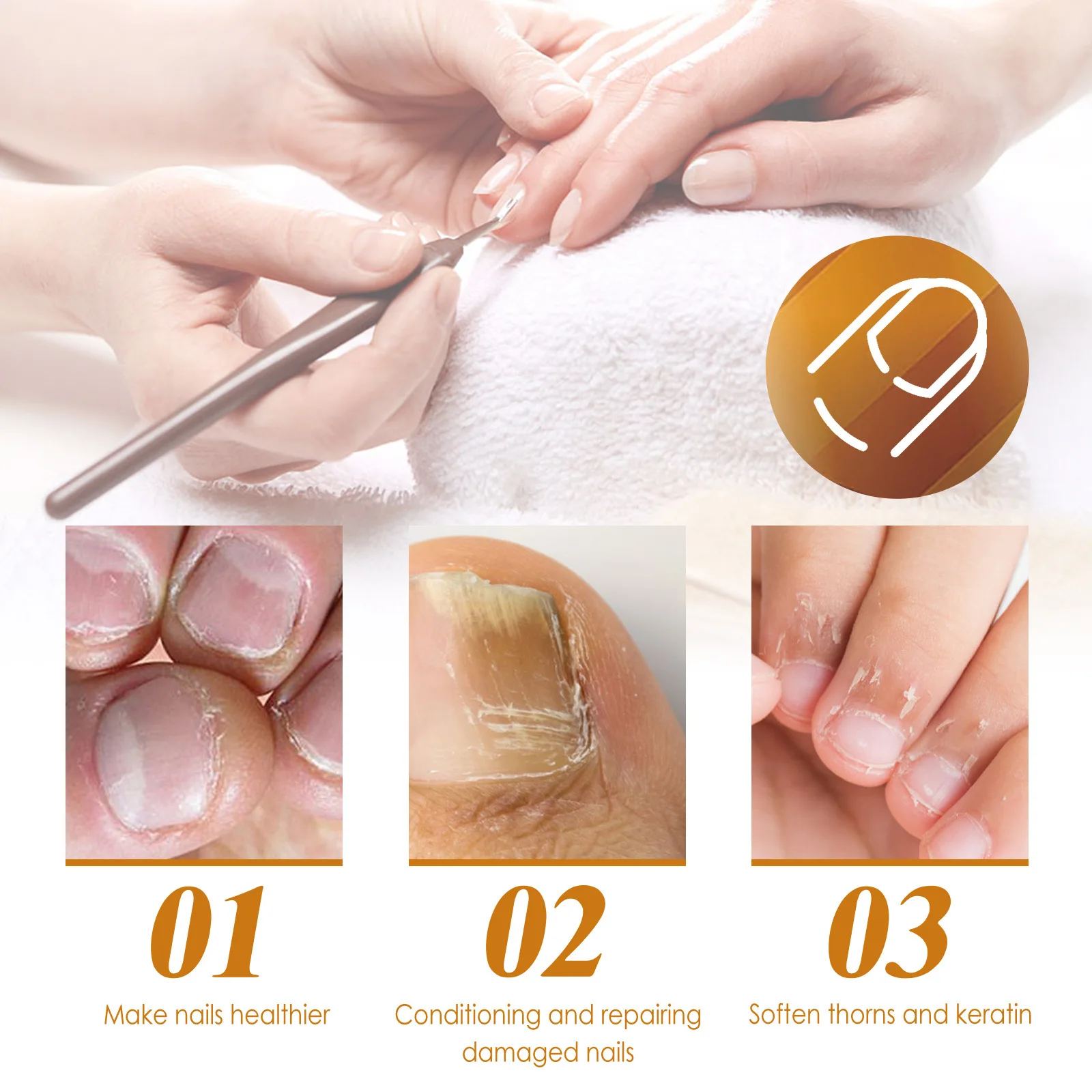 EELHOE Cuticle Remover Dead Skin Removal All for Manicure Nail Repair Treatment Cuticle Softener for Nails Nail Repair Gel 30ml