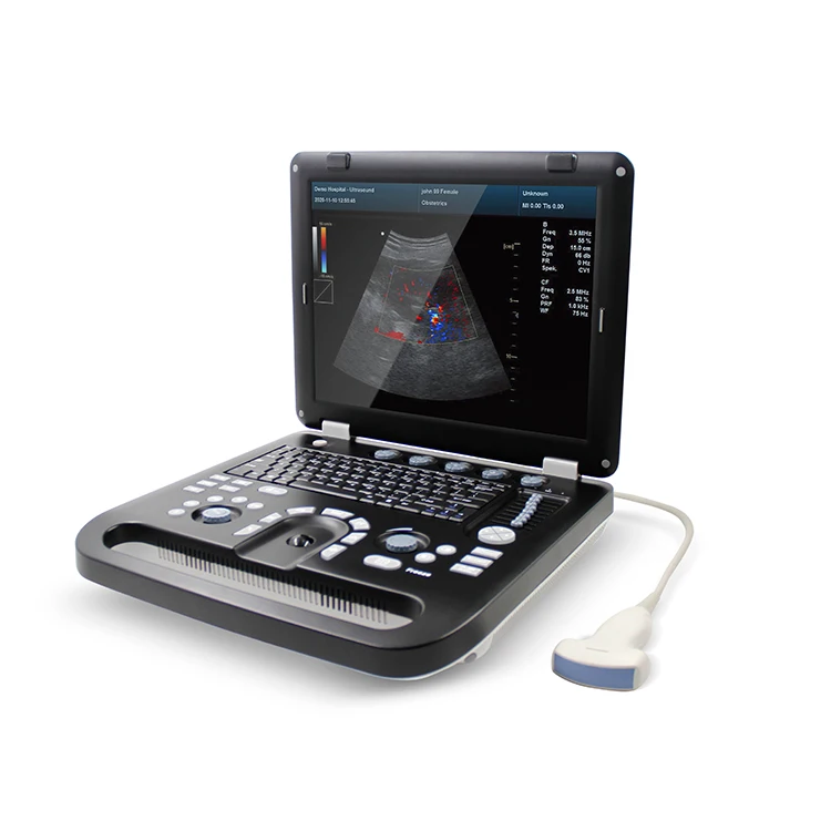 CONTEC CMS1700C portable color doppler ultrasound scanner 3 probe