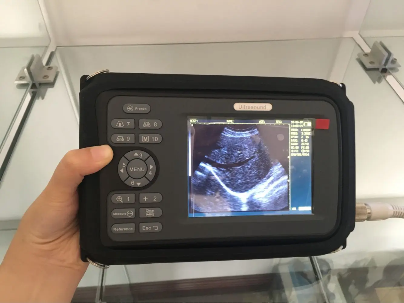 2D newest technology BW echo medical mini size ultrasound machine