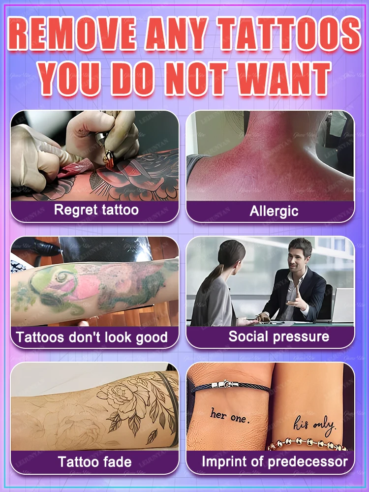 Tattoo-Auflösespray, Pflanzenextrakte, schnelle und effektive Tiefenreinigung, kein Laser erforderlich
