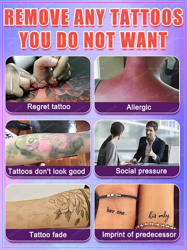 Imagen 2 del producto Eliminación de tatuajes rápida y eficaz, no requiere láser, sin dolor, sin marcas dejó