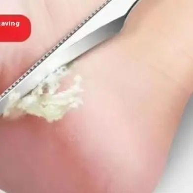 ที่ขูดเท้าแบบมืออาชีพ 5 ชิ้น ทำจากสแตนเลส สำหรับดูแลเท้า ขูดส้นเท้าแบบพกพา ขจัดเซลล์ผิวที่ตายแล้วและหนังด้าน